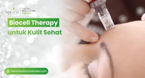 Jasa Biocell Therapy Manado untuk Kulit Sehat