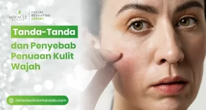 Kenali Tanda-Tanda dan Penyebab Penuaan yang Terjadi Pada Kulit Wajah!