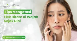 Tips Mengatasi Flek Hitam di Wajah Sejak Dini