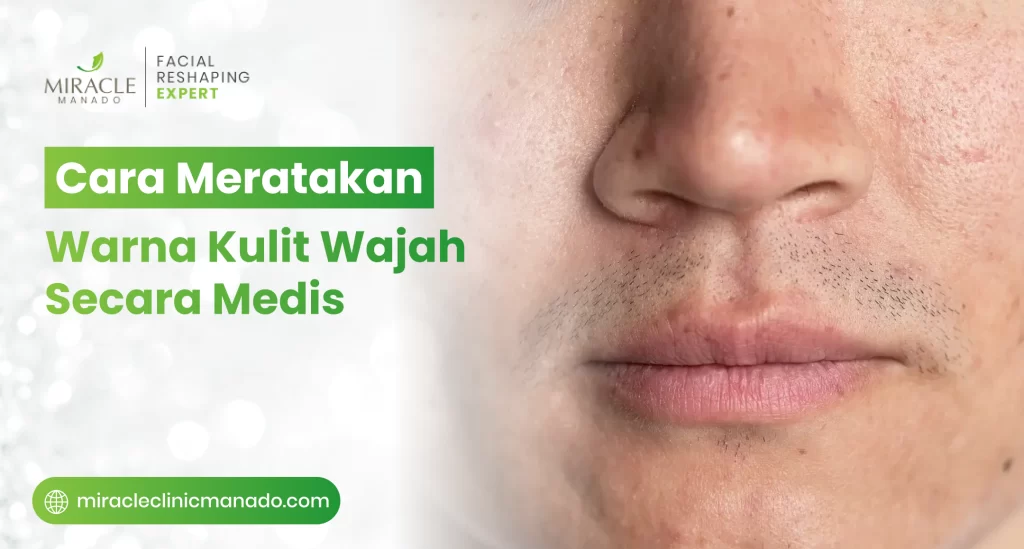 cara_meratakan_warna_kulit_wajah_secara_medis