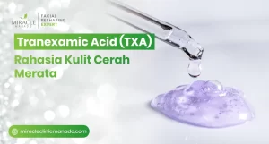 Tranexamic Acid (TXA), Rahasia Kulit Cerah Merata