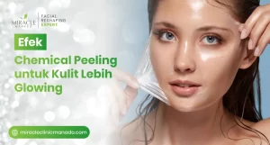 Efek Chemical Peeling untuk Kulit Lebih Glowing