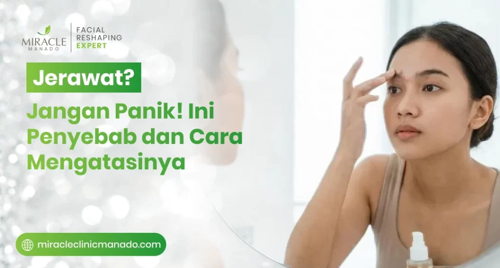 Jerawat Jangan Panik! Ini Penyebab dan Cara Mengatasinya